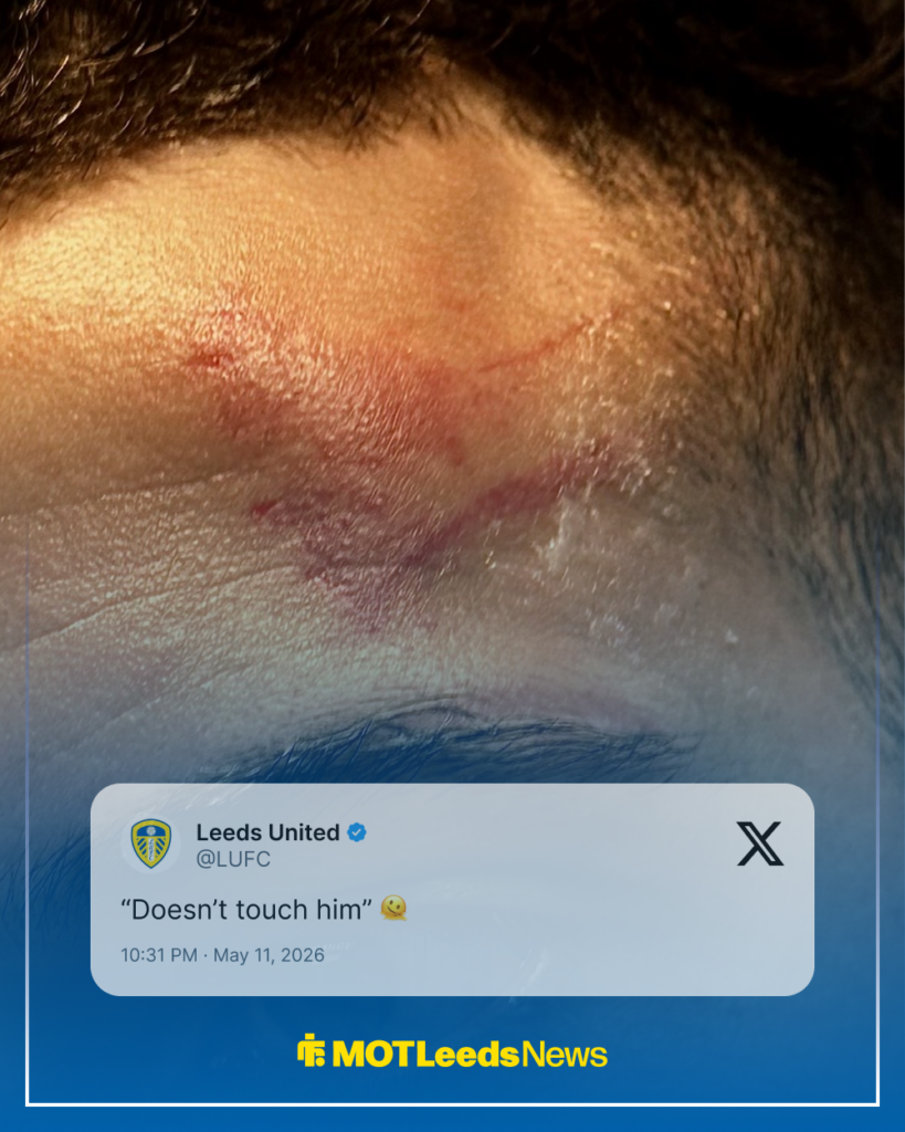 Leeds United Ethan Ampadu vs Tottenham